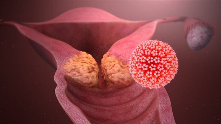 OPS y AECID refuerzan la cooperación en salud para eliminar el cáncer de cuello uterino